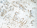 HNF1B Antibody in Immunohistochemistry (Paraffin) (IHC (P))