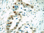 HNF1B Antibody in Immunohistochemistry (Paraffin) (IHC (P))