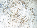 HNF1B Antibody in Immunohistochemistry (Paraffin) (IHC (P))