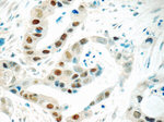 HNF1B Antibody in Immunohistochemistry (Paraffin) (IHC (P))