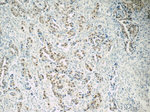 HNF1B Antibody in Immunohistochemistry (Paraffin) (IHC (P))