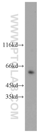 HNF1B Antibody in Western Blot (WB)