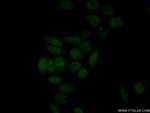 HNF1B Antibody in Immunocytochemistry (ICC/IF)