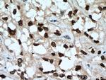 HNF1B Antibody in Immunohistochemistry (Paraffin) (IHC (P))