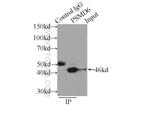 PSMD6 Antibody in Immunoprecipitation (IP)