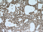 PIP5K1B Antibody in Immunohistochemistry (Paraffin) (IHC (P))