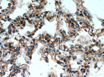 PIP5K1B Antibody in Immunohistochemistry (Paraffin) (IHC (P))