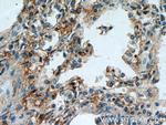 PIP5K1B Antibody in Immunohistochemistry (Paraffin) (IHC (P))