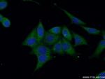 Annexin VI Antibody in Immunocytochemistry (ICC/IF)