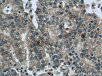 SQLE Antibody in Immunohistochemistry (Paraffin) (IHC (P))