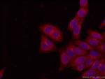 PEX5 Antibody in Immunocytochemistry (ICC/IF)