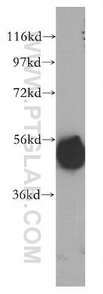CPVL Antibody in Western Blot (WB)