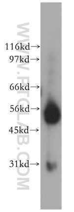 CPVL Antibody in Western Blot (WB)