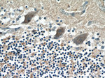 RGS17 Antibody in Immunohistochemistry (Paraffin) (IHC (P))