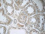 RGS17 Antibody in Immunohistochemistry (Paraffin) (IHC (P))