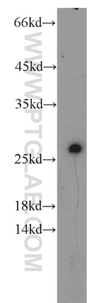 RGS17 Antibody in Western Blot (WB)