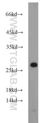 RGS17 Antibody in Western Blot (WB)