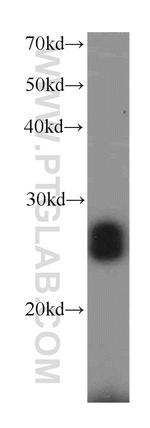 RGS17 Antibody in Western Blot (WB)