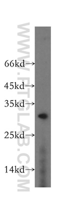 RGS17 Antibody in Western Blot (WB)