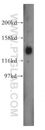 PER3 Antibody in Western Blot (WB)