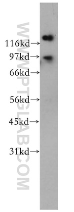 FXR2 Antibody in Western Blot (WB)