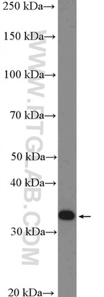 PPP2CB Antibody in Western Blot (WB)
