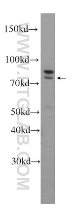 RAPGEF5 Antibody in Western Blot (WB)