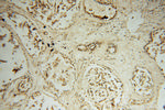 STK36 Antibody in Immunohistochemistry (Paraffin) (IHC (P))