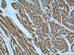 AK3 Antibody in Immunohistochemistry (Paraffin) (IHC (P))