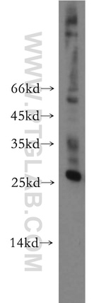 AK3 Antibody in Western Blot (WB)