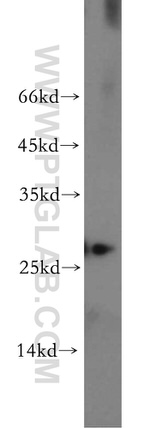 AK3 Antibody in Western Blot (WB)