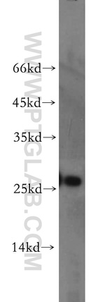 AK3 Antibody in Western Blot (WB)