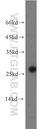 AK3 Antibody in Western Blot (WB)