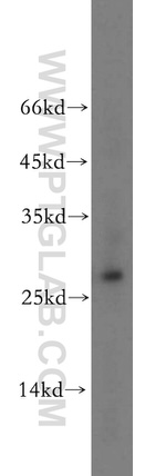 AK3 Antibody in Western Blot (WB)