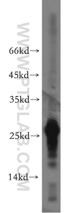 AK3 Antibody in Western Blot (WB)