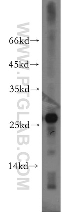AK3 Antibody in Western Blot (WB)