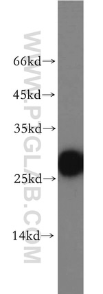 AK3 Antibody in Western Blot (WB)
