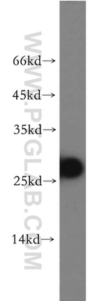 AK3 Antibody in Western Blot (WB)