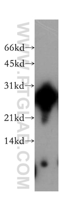 AK3 Antibody in Western Blot (WB)