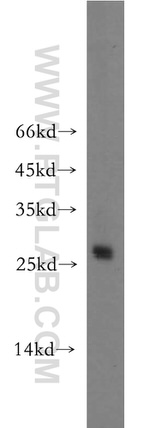 AK3 Antibody in Western Blot (WB)