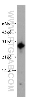 AK3 Antibody in Western Blot (WB)