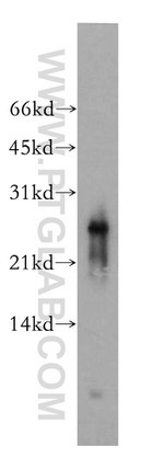 AK3 Antibody in Western Blot (WB)