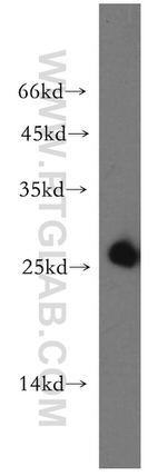 AK3 Antibody in Western Blot (WB)