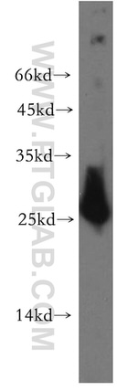 AK3 Antibody in Western Blot (WB)