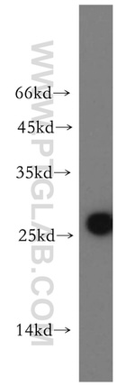 AK3 Antibody in Western Blot (WB)