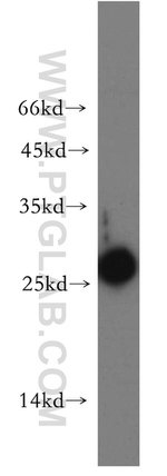 AK3 Antibody in Western Blot (WB)