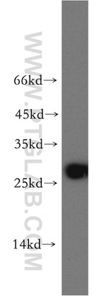 AK3 Antibody in Western Blot (WB)