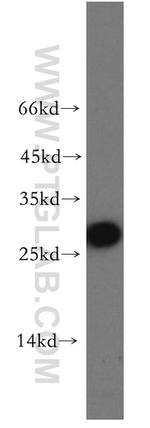 AK3 Antibody in Western Blot (WB)
