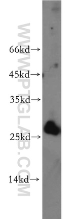 AK3 Antibody in Western Blot (WB)