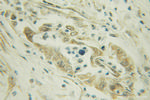 AK3 Antibody in Immunohistochemistry (Paraffin) (IHC (P))
